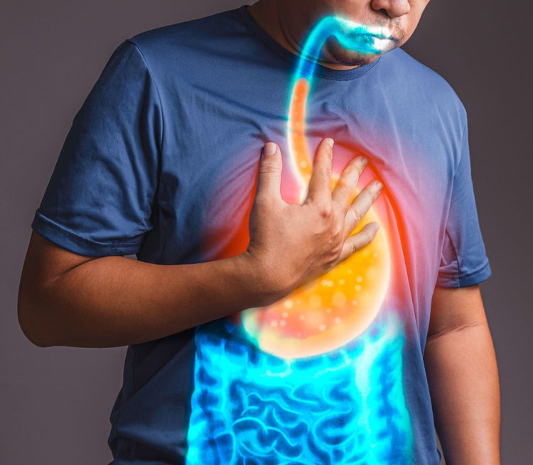 HEARTBURN, ACID REFLEX, ULCERS, GASTRITIS