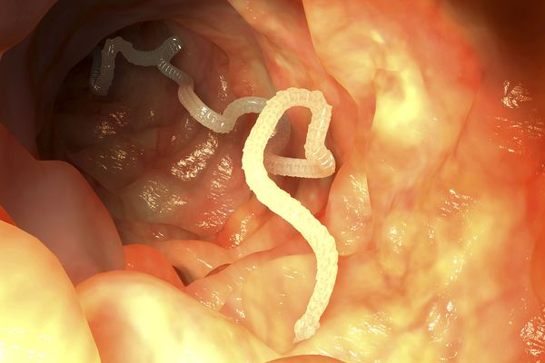 DESPARASITAR / PARASITES / H.PHILORY