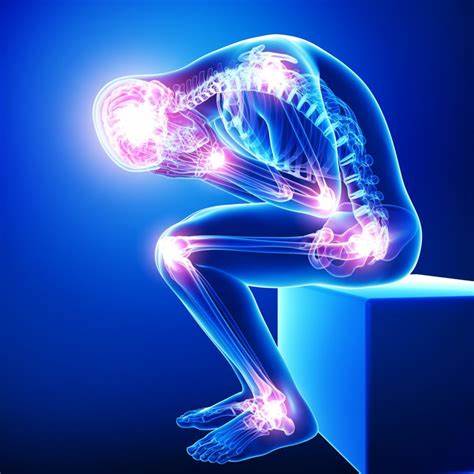 FIBROMYALGIA